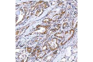 IHC analysis of Rab4/RAB4A using anti-Rab4/RAB4A antibody (ABIN7599733).