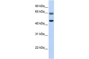 WB Suggested Anti-FAM113A Antibody Titration:  0. (FAM113A 抗体  (C-Term))