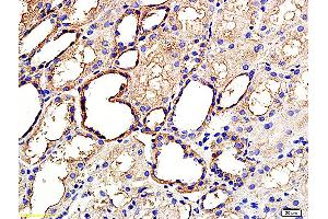 Formalin-fixed and paraffin embedded human kidney labeled with Anti ANGPTL3/ANG5 Polyclonal Antibody, Unconjugated (ABIN759806) at 1:200 followed by conjugation to the secondary antibody and DAB staining (ANGPTL3 抗体  (AA 21-120))