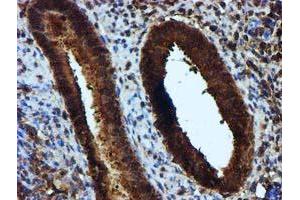 Immunohistochemical staining of paraffin-embedded Human endometrium tissue using anti-KEAP1 mouse monoclonal antibody. (KEAP1 抗体)