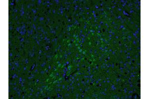 Paraformaldehyde-fixed, paraffin embedded rat brain; Antigen retrieval by boiling in sodium citrate buffer (pH6. (AKAP12 抗体  (AA 701-900))