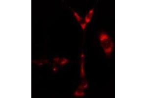 ABIN6276665 staining  Hela cells by IF/ICC. (CYP1B1 抗体  (Internal Region))