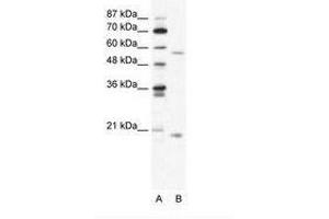 Image no. 1 for anti-Zinc Finger Protein 18 (ZNF18) (N-Term) antibody (ABIN202745) (ZNF18 抗体  (N-Term))