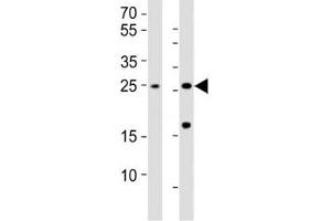 Western blot testing of RHOXF1 antibody at 1:1000; Lane 1: HL-60 whole lysate; Lane 2: human testis lysate. (RHOXF1 抗体  (AA 85-120))
