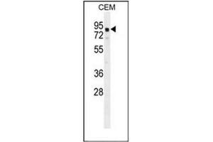 Western blot analysis of GLB1L2 Antibody (C-term) in CEM cell line lysates (35ug/lane).