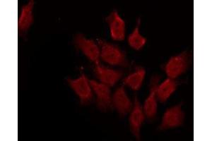 Immunofluorescence (fixed cells) (IF/ICC) image for anti-Tyrosine-Protein Phosphatase Non-Receptor Type 22 (PTPN22) (C-Term) antibody (ABIN6264518)