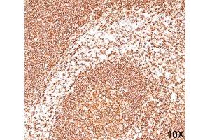 Immunohistochemistry (IHC) image for anti-Protein tyrosine Phosphatase, Receptor Type, C (PTPRC) antibody (ABIN3024376)