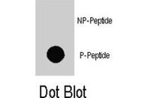 Dot blot analysis of MAP3K7IP1 (phospho S423) polyclonal antibody  on nitrocellulose membrane.