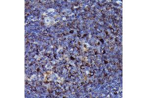 Immunohistochemistry of paraffin-embedded human tonsil using Human IgM Rabbit mAb (ABIN7267845) at dilution of 1:100 (40x lens). (IGHM 抗体)