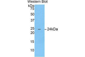 Western Blotting (WB) image for anti-Cathepsin B (CTSB) (AA 129-333) antibody (ABIN1858539) (Cathepsin B 抗体  (AA 129-333))