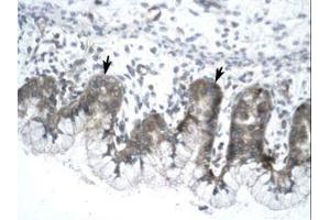 Image no. 1 for anti-Influenza Virus NS1A Binding Protein (IVNS1ABP) (N-Term) antibody (ABIN203235) (IVNS1ABP 抗体  (N-Term))