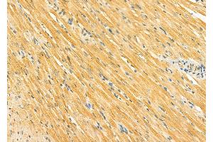 ABIN6265094 and ABIN6278291 at 1/100 staining Rat heart tissue by IHC-P. (SIRT5 抗体  (Internal Region))