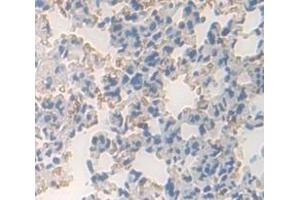 IHC-P analysis of Mouse Tissue, with DAB staining. (PDGFRL 抗体  (AA 22-375))