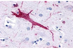 Anti-GPR116 antibody  ABIN1048694 IHC staining of human brain, neuron. (G Protein-Coupled Receptor 116 抗体  (N-Term))