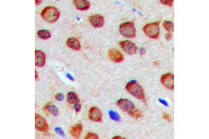 Immunohistochemical analysis of Nogo staining in human brain formalin fixed paraffin embedded tissue section. (Reticulon 4 抗体  (Center))