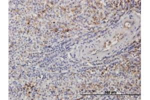 Immunoperoxidase of monoclonal antibody to TUBB2A on formalin-fixed paraffin-embedded human spleen. (TUBB2A 抗体  (AA 1-445))
