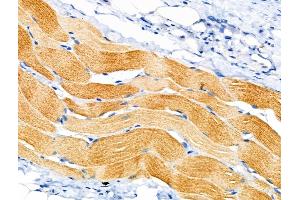 ABIN6258888 and ABIN6274835 at 1/100 staining Rat skin tissue by IHC-P. (SGCA 抗体  (Internal Region))