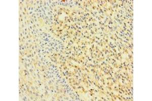 Immunohistochemistry (IHC) image for anti-Ras-Related C3 Botulinum Toxin Substrate 2 (Rho Family, Small GTP Binding Protein Rac2) (RAC2) (AA 1-189) antibody (ABIN7167200)