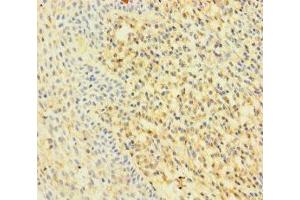Immunohistochemistry of paraffin-embedded human tonsil tissue using ABIN7167200 at dilution of 1:100 (RAC2 抗体  (AA 1-189))