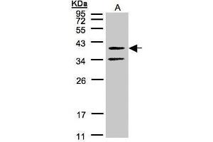WB Image Sample(30 μg of whole cell lysate) A:A431, 12% SDS PAGE antibody diluted at 1:500 (GALR2 抗体  (C-Term))