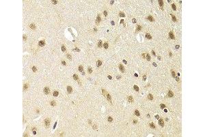 Immunohistochemistry of paraffin-embedded Rat brain using HEXIM1 Polyclonal Antibody at dilution of 1:100 (40x lens). (HEXIM1 抗体)
