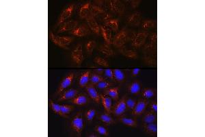 Immunofluorescence analysis of U-2 OS cells using HGS Rabbit pAb (ABIN6131749, ABIN6141748, ABIN6141749 and ABIN6218898) at dilution of 100 (40x lens). (HGS 抗体  (AA 548-777))