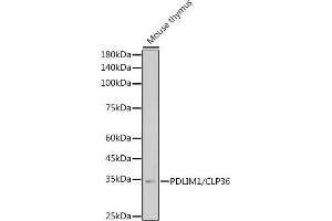 Western blot analysis of extracts of Mouse thymus, using PDLIM1/CLP36 antibody (ABIN7269195) at 1:1000 dilution. (PDLIM1 抗体)
