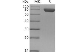 Sialic Acid Binding Ig-Like Lectin 8 (SIGLEC8) protein (Fc Tag)