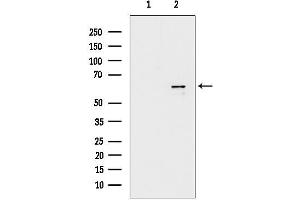 Western blot analysis of lysates from Rat lung, using DNA pol lambda Antibody.