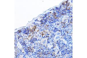 Immunohistochemistry (IHC) image for anti-Lymphocyte-Specific Protein tyrosine Kinase (LCK) (AA 1-240) antibody (ABIN3023130)