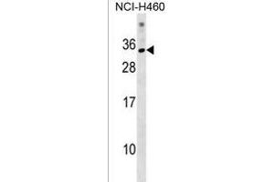 KRBOX1 Antibody (C-term) (ABIN1537656 and ABIN2838166) western blot analysis in NCI- cell line lysates (35 μg/lane). (KRBOX1 抗体  (C-Term))