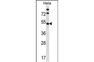 Western blot analysis in Hela cell line lysates (35ug/lane). (IP6K1 抗体  (N-Term))