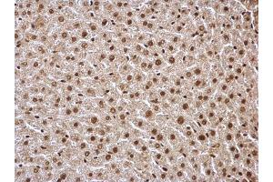 Immunohistochemistry (IHC) image for anti-Histone Deacetylase 1 (HDAC1) antibody (ABIN2854776)