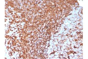 Immunohistochemistry (IHC) image for anti-Vimentin (VIM) (AA 2-466) antibody (ABIN6940884)