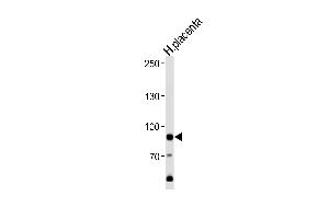 PD3 Antibody (Center) (ABIN1538324 and ABIN2841988) western blot analysis in human placenta tissue lysates (35 μg/lane). (AMPD3 抗体  (AA 325-356))