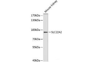 Western blot analysis of extracts of Mouse kidney using SLC22A2 Polyclonal Antibody at dilution of 1:1000. (SLC22A2 抗体)