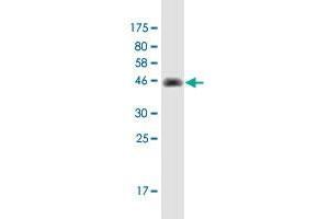 Western Blot detection against Immunogen (42. (CARHSP1 抗体  (AA 1-147))