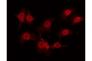 ABIN6268929 staining K562 by IF/ICC. (TRAF2 抗体  (C-Term))