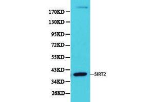 Western Blotting (WB) image for anti-Sirtuin 2 (SIRT2) antibody (ABIN1874785) (SIRT2 抗体)