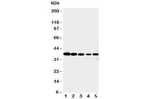 Western blot testing of Cdk7 antibody and Lane 1:  HeLa;  2: MCF-7;  3: A549;  4: COLO320;  5: Jurkat cell lysate. (CDK7 抗体  (C-Term))