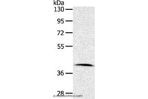 Western blot analysis of Human lymphoma tissue, using CDK10 Polyclonal Antibody at dilution of 1:100 (CDK10 抗体)