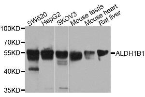 Western blot analysis of extracts of various cell lines, using ALDH1B1 antibody. (ALDH1B1 抗体  (AA 278-517))