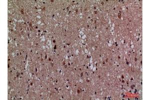 Immunohistochemistry (IHC) analysis of paraffin-embedded Human Brain, antibody was diluted at 1:100. (CDK4 抗体  (N-Term))