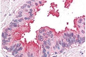Human Prostate: Formalin-Fixed, Paraffin-Embedded (FFPE) (ERAP1 抗体  (Internal Region))
