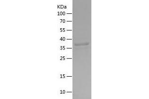 Western Blotting (WB) image for Sequestosome 1 (SQSTM1) (AA 108-237) protein (His-IF2DI Tag) (ABIN7125031) (SQSTM1 Protein (AA 108-237) (His-IF2DI Tag))