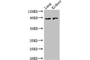 Western Blot Positive WB detected in: Mouse lung tissue, Mouse kidney tissue All lanes: NAALADL2 antibody at 3. (NAALADL2 抗体  (AA 143-795))