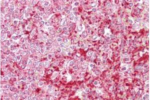 Immunohistochemistry with Spleen tissue at an antibody concentration of 5µg/ml using anti-ETV5 antibody (ARP31658_P050) (ETV5 抗体  (N-Term))