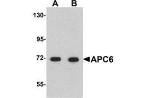 Western blot analysis of APC6 in human liver tissue lysate with AP30062PU-N APC6 antibody at (A) 1 and (B) 2 μg/ml.