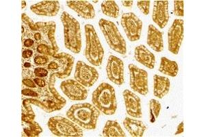 Immunohistochemistry (IHC) image for anti-CD209 (CD209) (Extracellular Domain) antibody (ABIN1030833)