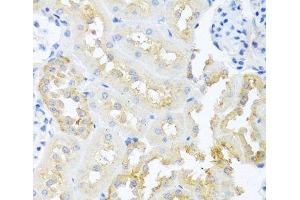 Immunohistochemistry of paraffin-embedded Rat kidney using TDGF1 Polyclonal Antibody at dilution of 1:100 (40x lens). (TDGF1 抗体)